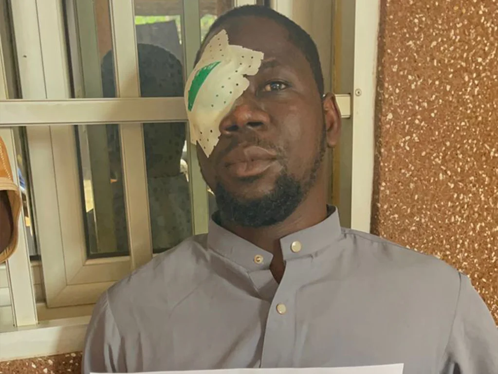 Patient after cataract surgery with eye bandage